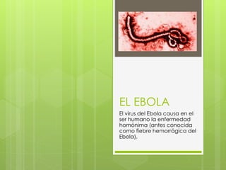 EL EBOLA
El virus del Ebola causa en el
ser humano la enfermedad
homónima (antes conocida
como fiebre hemorrágica del
Ebola).
 