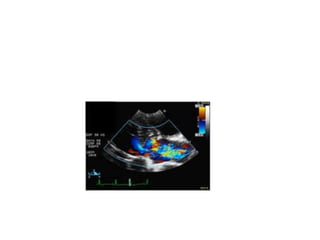 Electrical and Electronics Ebgineering _ Dr Paul K Joseph 