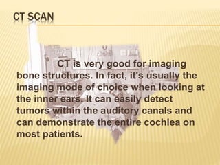 CT SCAN
CT is very good for imaging
bone structures. In fact, it's usually the
imaging mode of choice when looking at
the inner ears. It can easily detect
tumors within the auditory canals and
can demonstrate the entire cochlea on
most patients.
 