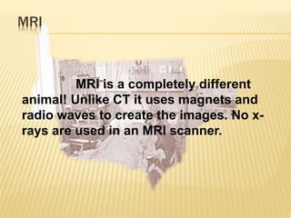 MRI
MRI is a completely different
animal! Unlike CT it uses magnets and
radio waves to create the images. No x-
rays are used in an MRI scanner.
 