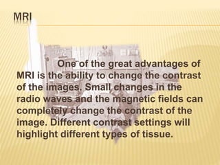 MRI
One of the great advantages of
MRI is the ability to change the contrast
of the images. Small changes in the
radio waves and the magnetic fields can
completely change the contrast of the
image. Different contrast settings will
highlight different types of tissue.
 