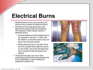 © Business & Legal Reports, Inc. 0605
Electrical Burns
• Electrical burns are a very common and
serious injury caused by electrical shock.
• Electricity in the body generates heat,
because the body produces resistance.
The heating of body tissues results in
electrical burns.
• Second-degree and third-degree burns
can appear on the skin, or they may
be internal, so that the person may not
look to be seriously injured.
• While electrical burns may look minor
from the outside they might be severe
on the inside, due to the damage they
have caused to internal organs and
tissues.
• Thermal burns also can occur from
contacting surfaces that are extremely hot
due to electricity, or when clothing or
equipment catches fire.
 