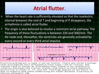Electocardiography by aamir sharif | PPTX