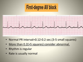 Electrical activity of heart | PPTX