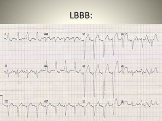 Electrical activity of heart | PPTX