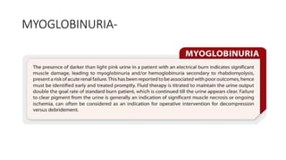 MYOGLOBINURIA-
 