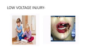 LOW VOLTAGE INJURY-
 