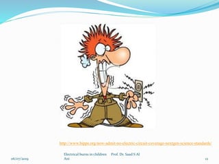 06/07/2019
Electrical burns in children Prof. Dr. Saad S Al
Ani 12
http://www.bipps.org/now-admit-no-electric-circuit-coverage-nextgen-science-standards/
 