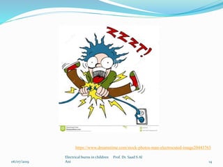 06/07/2019
Electrical burns in children Prof. Dr. Saad S Al
Ani 14
https://www.dreamstime.com/stock-photos-man-electrocuted-image20443763
 