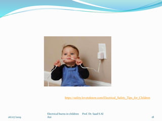 06/07/2019
Electrical burns in children Prof. Dr. Saad S Al
Ani 18
https://safety.lovetoknow.com/Electrical_Safety_Tips_for_Children
 