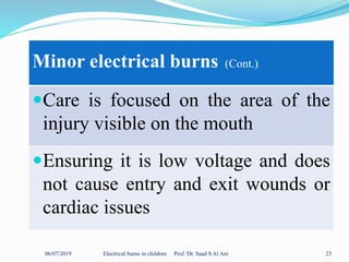 06/07/2019 Electrical burns in children Prof. Dr. Saad S Al Ani 23
Minor electrical burns (Cont.)
Care is focused on the area of the
injury visible on the mouth
Ensuring it is low voltage and does
not cause entry and exit wounds or
cardiac issues
 