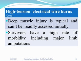06/07/2019 Electrical burns in children Prof. Dr. Saad S Al Ani 26
High-tension electrical wire burns
(Cont.)
Deep muscle injury is typical and
can’t be readily assessed initially
Survivors have a high rate of
morbidity including major limb
amputations
 