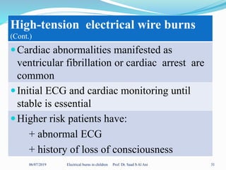 06/07/2019 Electrical burns in children Prof. Dr. Saad S Al Ani 31
High-tension electrical wire burns
(Cont.)
Cardiac abnormalities manifested as
ventricular fibrillation or cardiac arrest are
common
Initial ECG and cardiac monitoring until
stable is essential
Higher risk patients have:
+ abnormal ECG
+ history of loss of consciousness
 