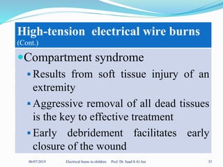 06/07/2019 Electrical burns in children Prof. Dr. Saad S Al Ani 33
High-tension electrical wire burns
(Cont.)
Compartment syndrome
 Results from soft tissue injury of an
extremity
 Aggressive removal of all dead tissues
is the key to effective treatment
 Early debridement facilitates early
closure of the wound
 