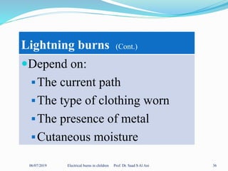 06/07/2019 Electrical burns in children Prof. Dr. Saad S Al Ani 36
Lightning burns (Cont.)
Depend on:
The current path
The type of clothing worn
The presence of metal
Cutaneous moisture
 