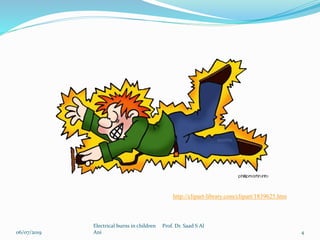 06/07/2019
Electrical burns in children Prof. Dr. Saad S Al
Ani 4
http://clipart-library.com/clipart/1839625.htm
 