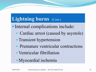 06/07/2019 Electrical burns in children Prof. Dr. Saad S Al Ani 41
Lightning burns (Cont.)
Internal complications include:
 Cardiac arrest (caused by asystole)
 Transient hypertension
 Premature ventricular contractions
 Ventricular fibrillation
 Myocardial ischemia
 