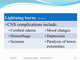06/07/2019 Electrical burns in children Prof. Dr. Saad S Al Ani 42
Lightning burns (Cont.)
CNS complications include:
 Cerebral edema  Mood changes
 Hemorrhage  Depression
 Seizures  Paralysis of lower
extremities
 