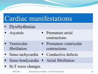 06/07/2019 Electrical burns in children Prof. Dr. Saad S Al Ani 46
Cardiac manifestations
• Dysrhythmias
 Asystole  Premature atrial
contractions
 Ventricular
fibrillation
 Premature ventricular
contractions
 Sinus tachycardia  Conductive defects
 Sinus bradycardia  Atrial fibrillation
 St-T wave changes
 