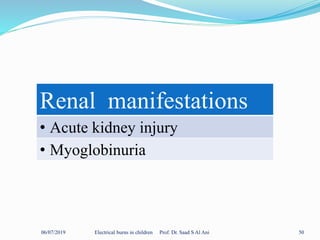 06/07/2019 Electrical burns in children Prof. Dr. Saad S Al Ani 50
Renal manifestations
• Acute kidney injury
• Myoglobinuria
 