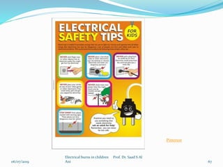 06/07/2019
Electrical burns in children Prof. Dr. Saad S Al
Ani 67
Pinterest
 