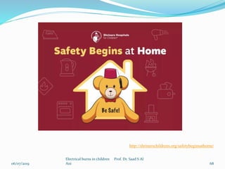 06/07/2019
Electrical burns in children Prof. Dr. Saad S Al
Ani 68
http://shrinerschildrens.org/safetybeginsathome/
 
