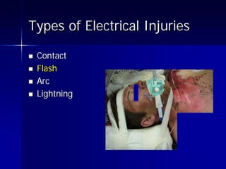 Electrical Campaign Presentation | PDF