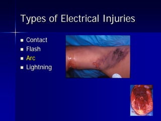 Electrical Campaign Presentation | PDF