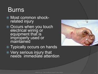 Burns
 Most common shock-
related injury
 Occurs when you touch
electrical wiring or
equipment that is
improperly used or
maintained
 Typically occurs on hands
 Very serious injury that
needs immediate attention
OSHAX.org - The Unofficial Guide To the OSHA 9
 