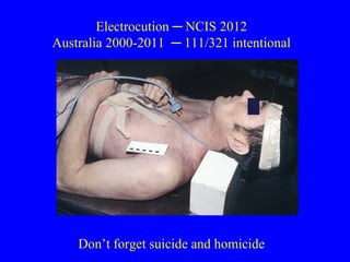 Electricity and Electrical Injuries | PPT