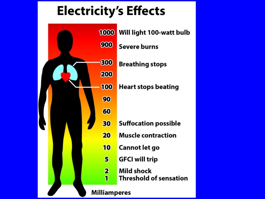 Electricity and Electrical Injuries