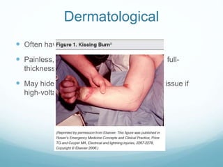 Dermatological
 Often have entry and exit burns
 Painless, grey to yellow depressed areas if full-
thickness
 May hide extensive underlying damage to tissue if
high-voltage injury
 