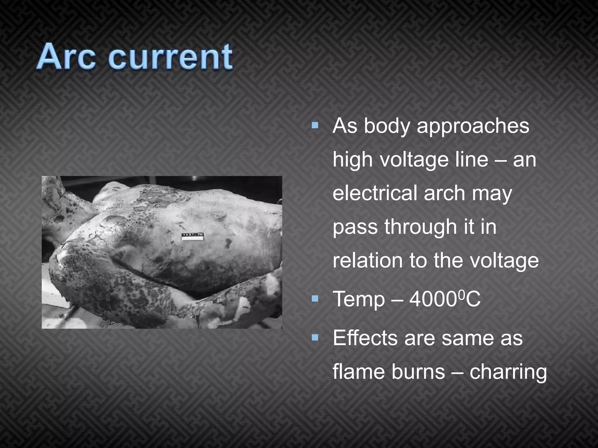Electrical injuries Dr Ashutosh | PPTX