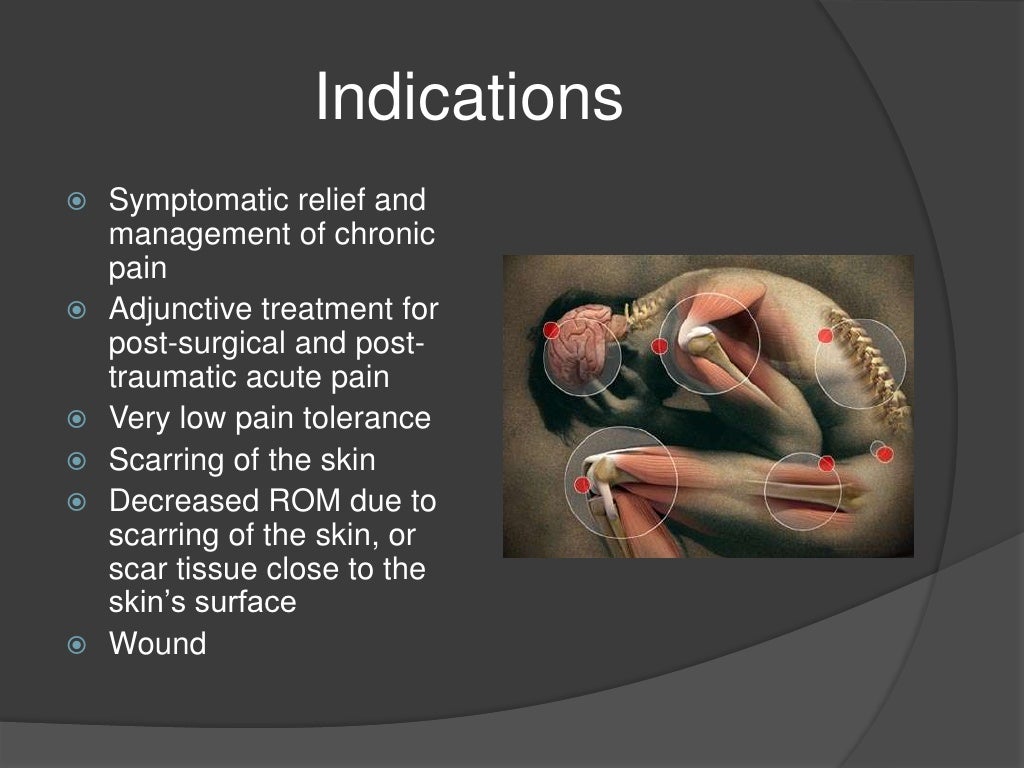 Electrical Modalities