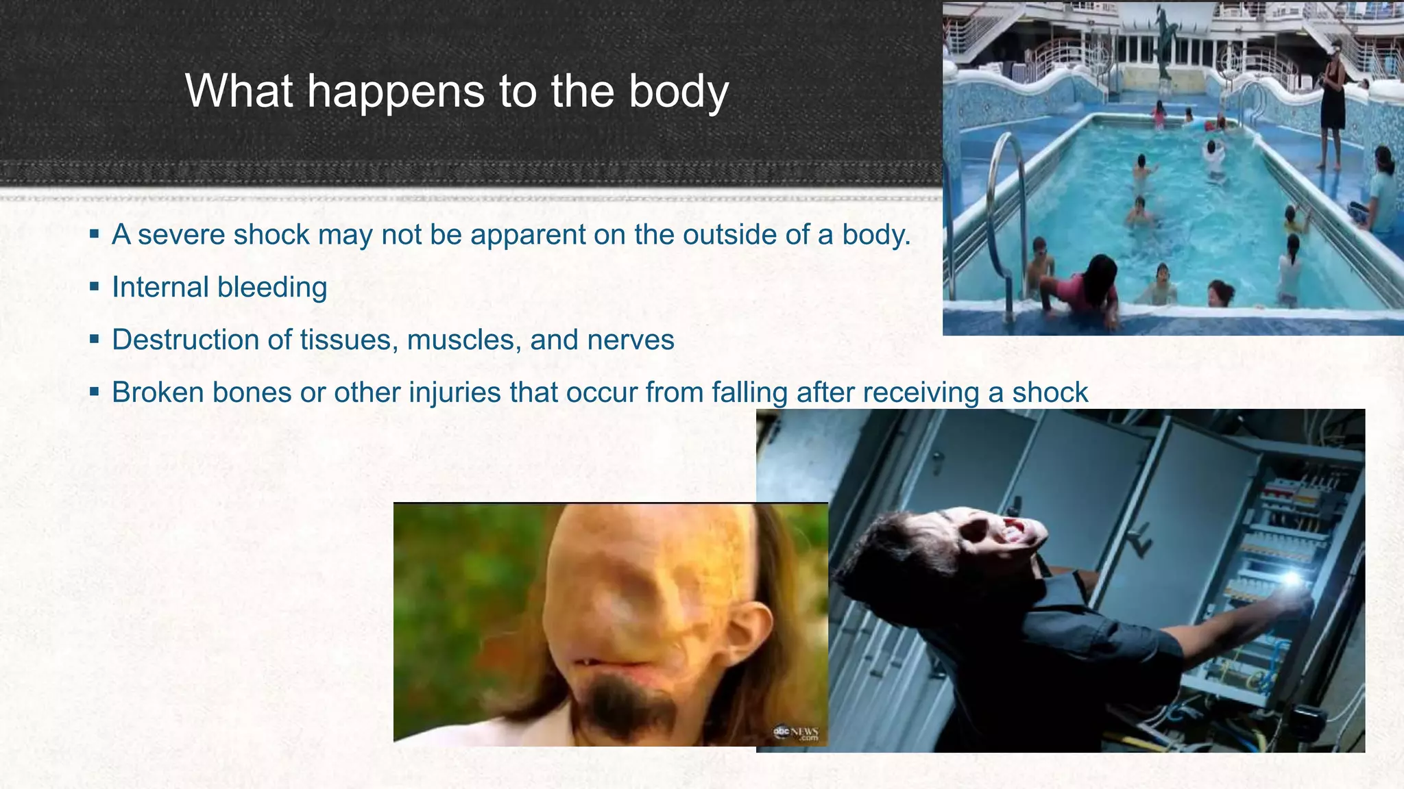 What happens to the body
 A severe shock may not be apparent on the outside of a body.
 Internal bleeding
 Destruction of tissues, muscles, and nerves
 Broken bones or other injuries that occur from falling after receiving a shock
 