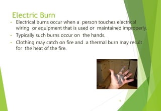 Electric Burn
• Electrical burns occur when a person touches electrical
wiring or equipment that is used or maintained improperly.
• Typically such burns occur on the hands.
• Clothing may catch on fire and a thermal burn may result
for the heat of the fire.
18
 