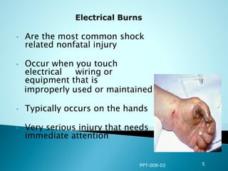 • Are the most common shock
related nonfatal injury
• Occur when you touch
electrical wiring or
equipment that is
improperly used or maintained
• Typically occurs on the hands
• Very serious injury that needs
immediate attention
PPT-008-02 5
 