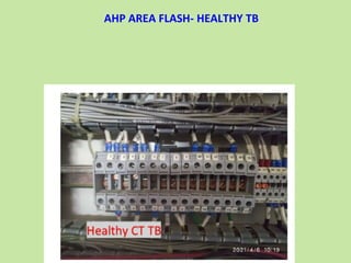 AHP AREA FLASH- HEALTHY TB
 