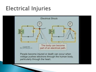  Shock Current
Path
◦ Why have it a
ground free lines?
 