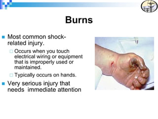 Burns
 Most common shock-
related injury.
 Occurs when you touch
electrical wiring or equipment
that is improperly used or
maintained.
 Typically occurs on hands.
 Very serious injury that
needs immediate attention
 