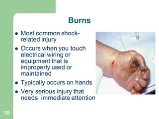 10
Burns
⚫ Most common shock-
related injury
⚫ Occurs when you touch
electrical wiring or
equipment that is
improperly used or
maintained
⚫ Typically occurs on hands
⚫ Very serious injury that
needs immediate attention
 