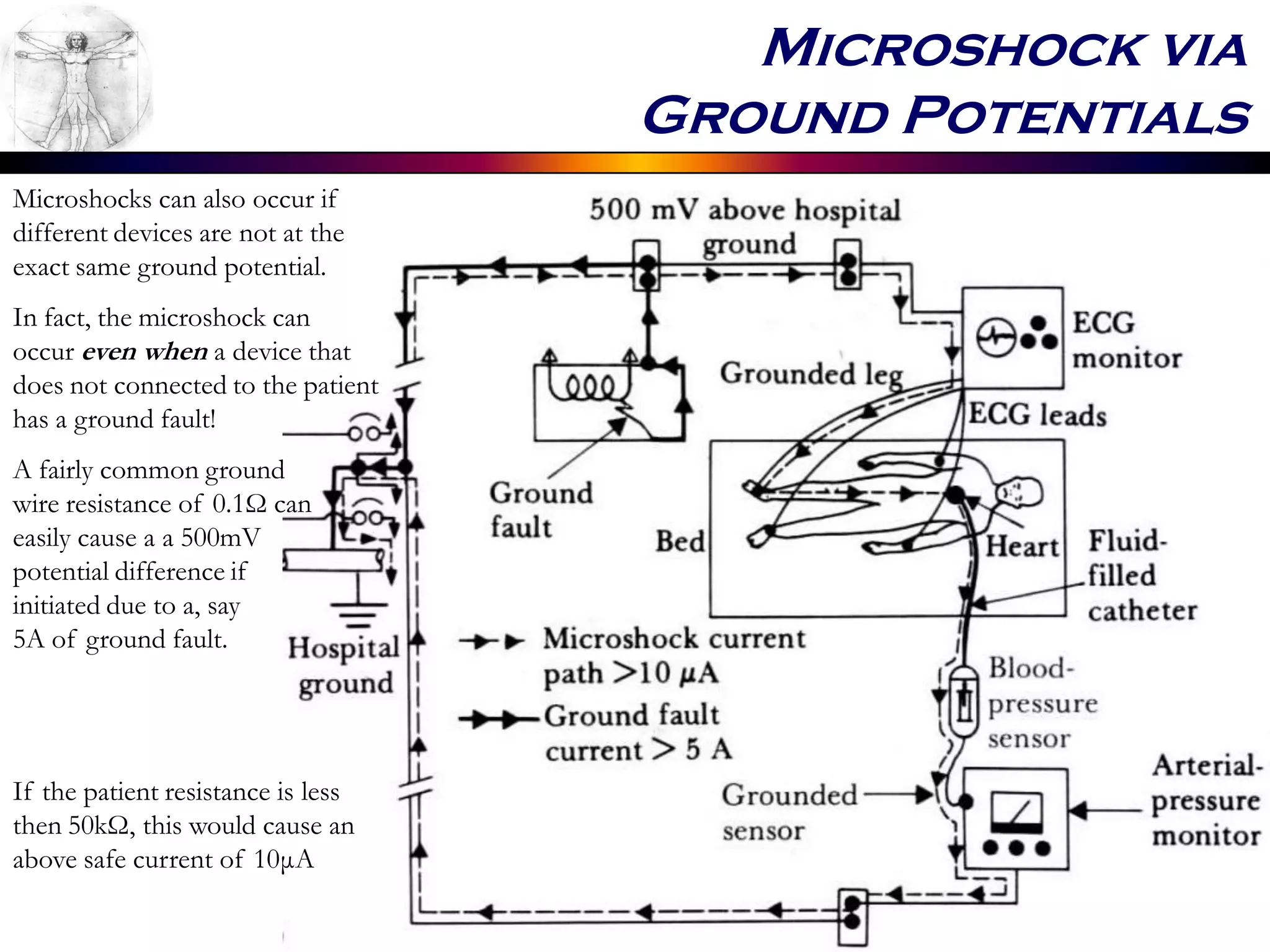 Microshock via
Ground Potentials
Microshocks can also occur if
different devices are not at the
exact same ground potential.
In fact, the microshock can
occur even when a device that
does not connected to the patient
has a ground fault!
A fairly common ground
wire resistance of 0.1Ω can
easily cause a a 500mV
potential difference if
initiated due to a, say
5A of ground fault.
If the patient resistance is less
then 50kΩ, this would cause an
above safe current of 10μA
 