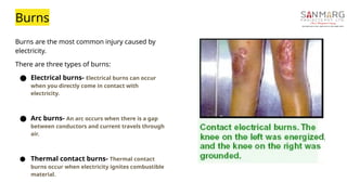 Electric Burn Example Comprehensive Electrical Safety Training: Hazards, Controls, and Best ...