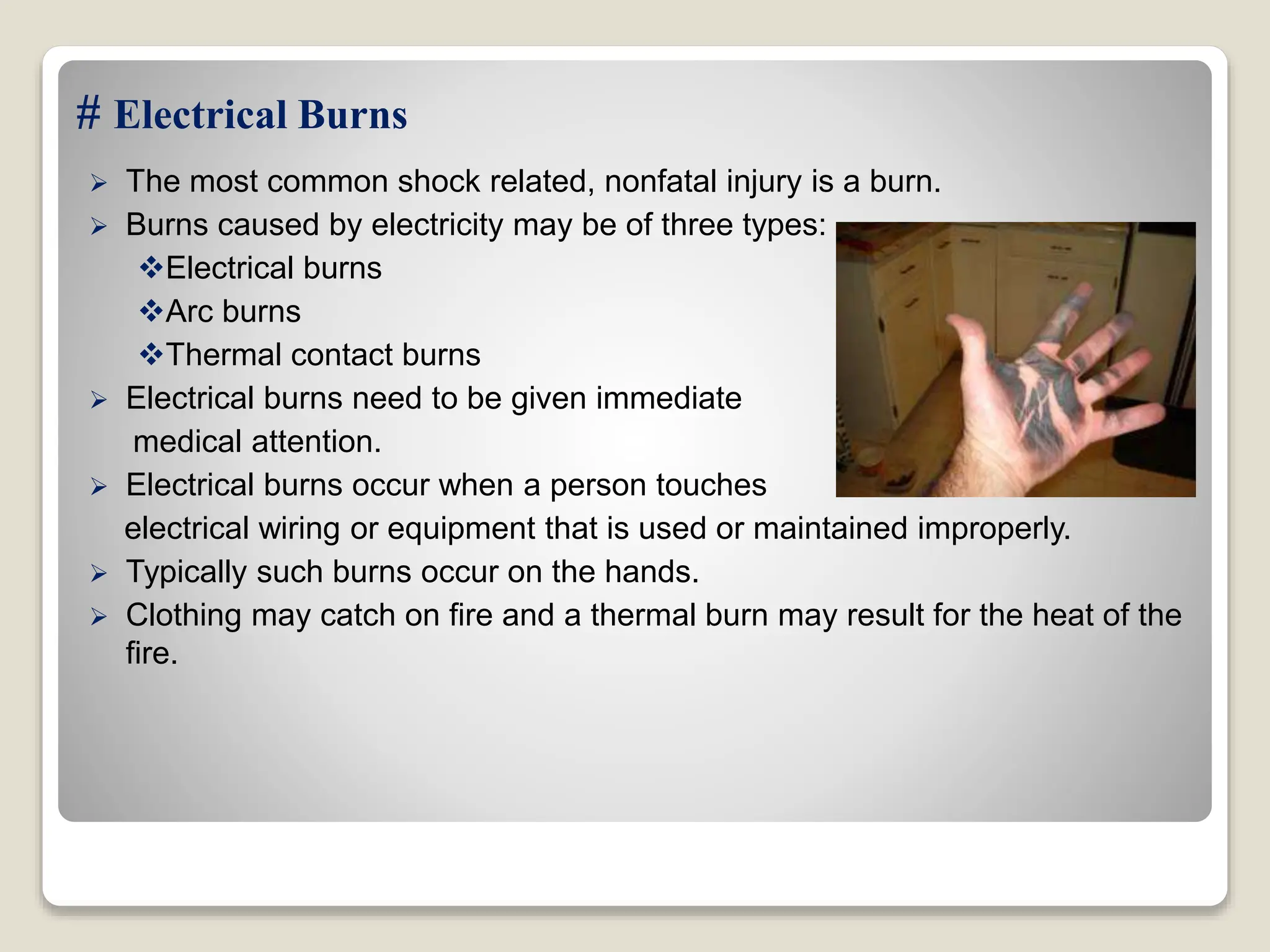 # Electrical Burns
 The most common shock related, nonfatal injury is a burn.
 Burns caused by electricity may be of three types:
Electrical burns
Arc burns
Thermal contact burns
 Electrical burns need to be given immediate
medical attention.
 Electrical burns occur when a person touches
electrical wiring or equipment that is used or maintained improperly.
 Typically such burns occur on the hands.
 Clothing may catch on fire and a thermal burn may result for the heat of the
fire.
 
