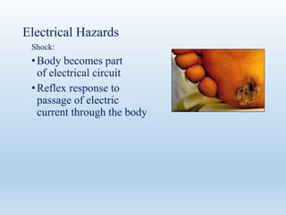 Electrical Hazards
Shock:
•Body becomes part
of electrical circuit
•Reflex response to
passage of electric
current through the body
 