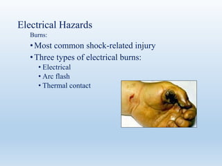 Electrical Hazards
Burns:
•Most common shock-related injury
•Three types of electrical burns:
• Electrical
• Arc flash
• Thermal contact
 