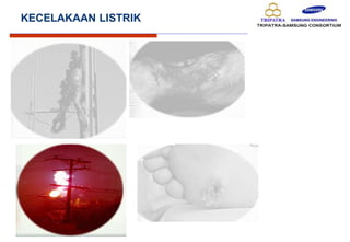 KECELAKAAN LISTRIK
 