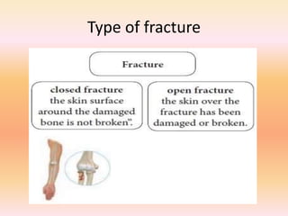 Type of fracture
 