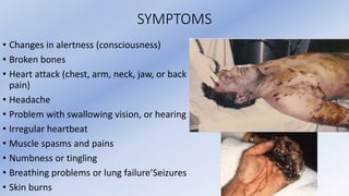 SYMPTOMS
• Changes in alertness (consciousness)
• Broken bones
• Heart attack (chest, arm, neck, jaw, or back
pain)
• Headache
• Problem with swallowing vision, or hearing
• Irregular heartbeat
• Muscle spasms and pains
• Numbness or tingling
• Breathing problems or lung failure’Seizures
• Skin burns
 