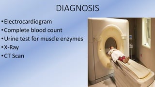 DIAGNOSIS
•Electrocardiogram
•Complete blood count
•Urine test for muscle enzymes
•X-Ray
•CT Scan
 